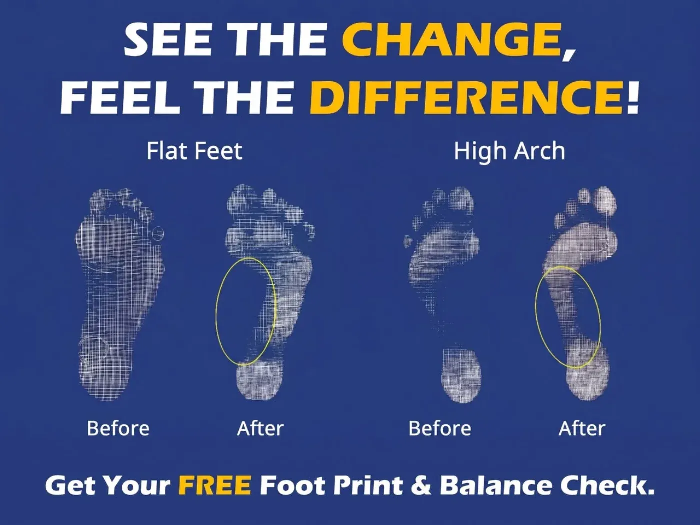 Before and after footprints for flat feet and high arches